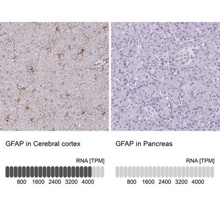 Merck Anti-GFAP antibody produced in rabbit