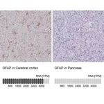 Merck Anti-GFAP antibody produced in rabbit