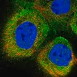 Merck Anti-SLC28A1 antibody produced in rabbit