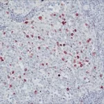 Merck ANTI-HUMAN IGM (MU CHAIN SPECIFIC)