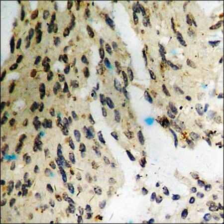 Merck Anti-phospho-Dab1 (pTyr232) antibody produced in rabbit