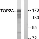 Merck Anti-TOP2A antibody produced in rabbit