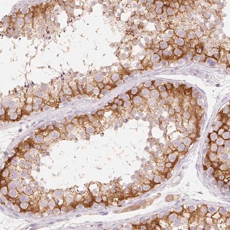 Merck Anti-MBOAT7 antibody produced in rabbit