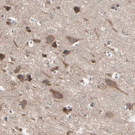 Merck Anti-PNPLA7 antibody produced in rabbit