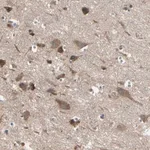 Merck Anti-PNPLA7 antibody produced in rabbit