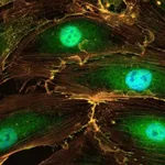 Thermo Fisher Scientific Donkey anti-Rabbit IgG (H+L) ReadyProbes Secondary Antibody, Alexa Fluor 488