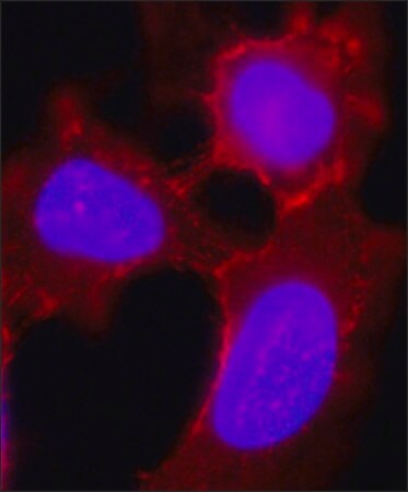 Merck Anti-Desmoglein 2 (DSG2) antibody, Mouse monoclonal