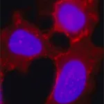 Merck Anti-Desmoglein 2 (DSG2) antibody, Mouse monoclonal