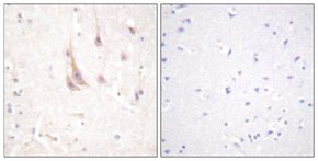 Merck ANTI-PKC ? ANTIBODY PRODUCED IN RABBIT