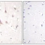 Merck ANTI-PKC ? ANTIBODY PRODUCED IN RABBIT