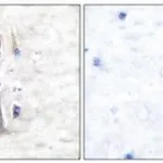 Merck ANTI-GLUT1 ANTIBODY PRODUCED IN RABBIT