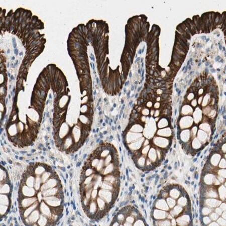 Merck Anti-DUSP12 antibody produced in rabbit