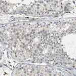 Merck ANTI-PTGDS ANTIBODY PRODUCED IN RABBIT &