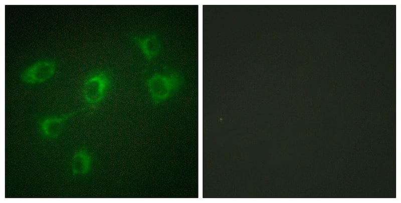 Merck Anti-TGF beta Receptor III antibody produced in rabbit