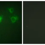 Merck Anti-TGF beta Receptor III antibody produced in rabbit