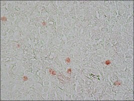 Merck MONOCLONAL ANTI-PROLIFERATING PROTEIN K&