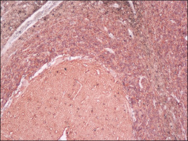 Merck Anti-Neuron-Specific Enolase (NSE) antibody, Mouse monoclonal