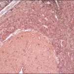 Merck Anti-Neuron-Specific Enolase (NSE) antibody, Mouse monoclonal