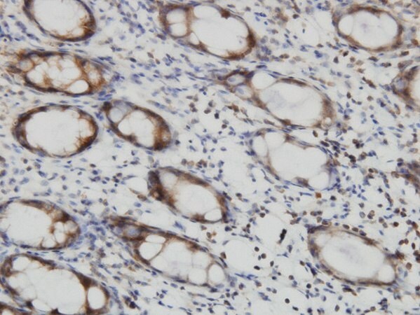 Merck Monoclonal Anti-RALB antibody produced in mouse