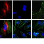 Thermo Fisher Scientific Donkey anti-Rabbit IgG (H+L) Cross-Adsorbed Secondary Antibody, Rhodamine