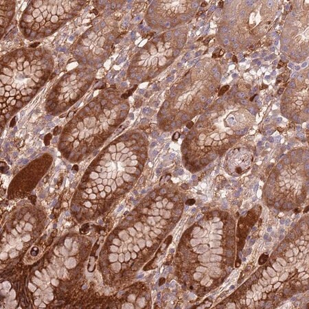 Merck Anti-NADK antibody produced in rabbit