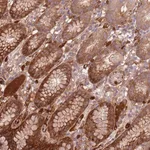 Merck Anti-NADK antibody produced in rabbit