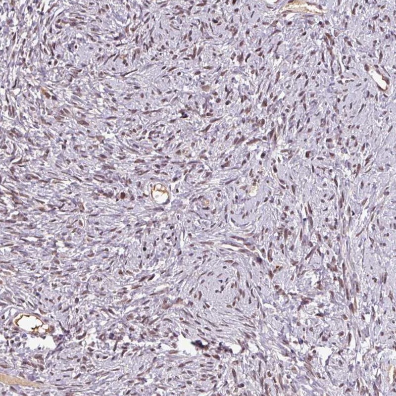Atlas Antibodies Anti-NOB1 Antibody