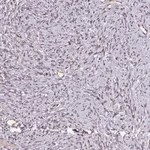 Atlas Antibodies Anti-NOB1 Antibody