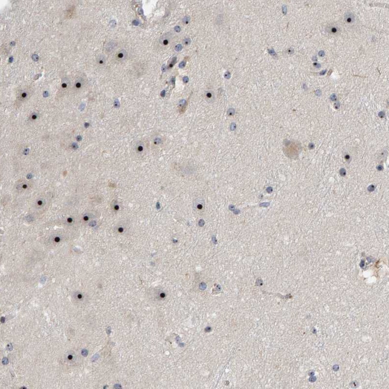 Atlas Antibodies Anti-NOL11 Antibody