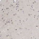 Atlas Antibodies Anti-NOL11 Antibody