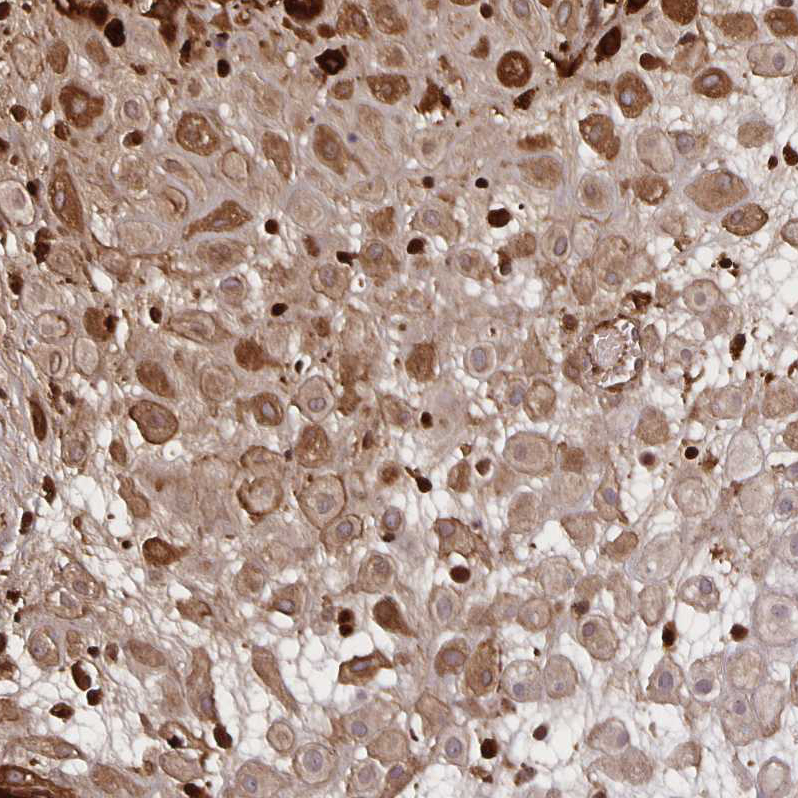 Atlas Antibodies Anti-NOG Antibody