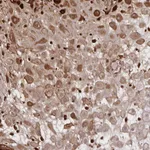 Atlas Antibodies Anti-NOG Antibody