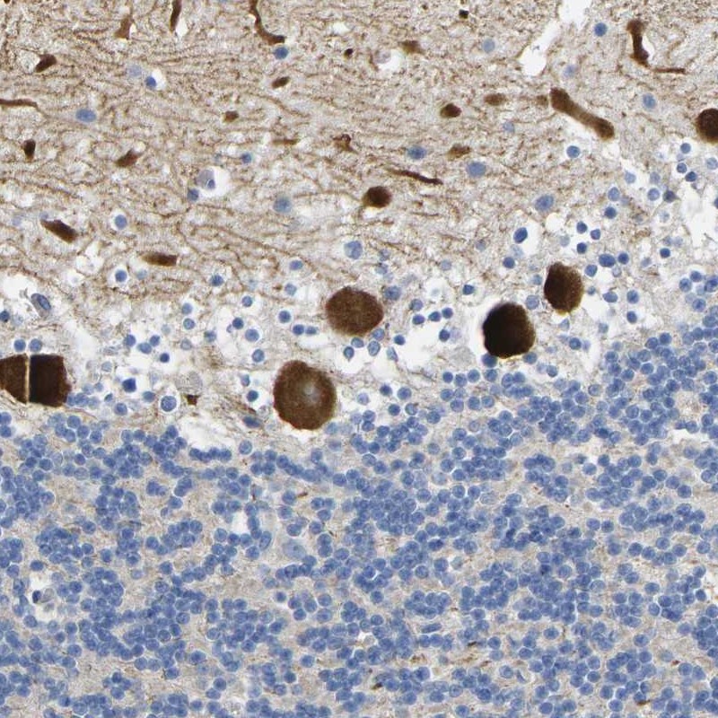 Atlas Antibodies Anti-NOCT Antibody