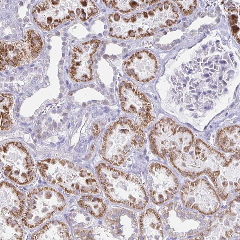 Atlas Antibodies Anti-NOCT Antibody