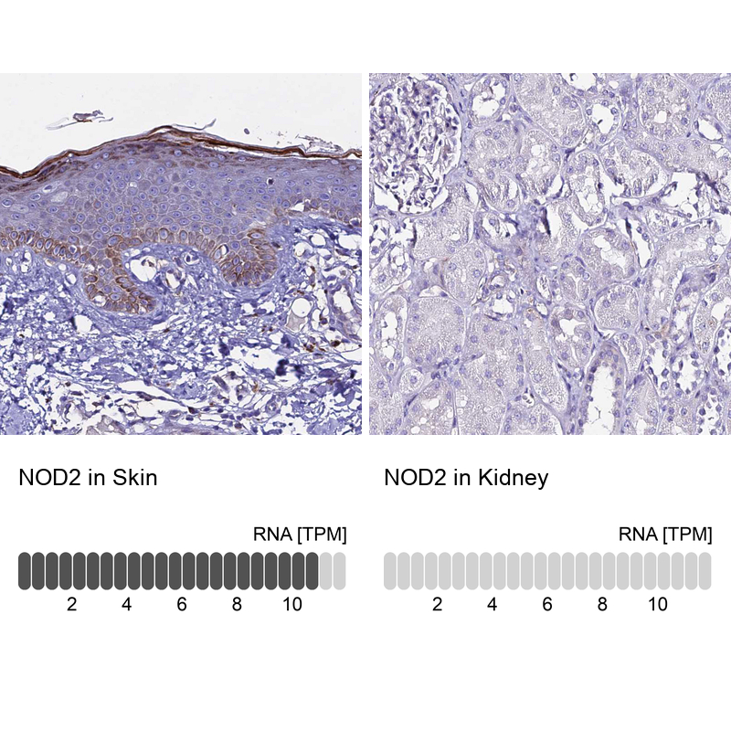 Atlas Antibodies Anti-NOD2 Antibody