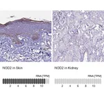 Atlas Antibodies Anti-NOD2 Antibody