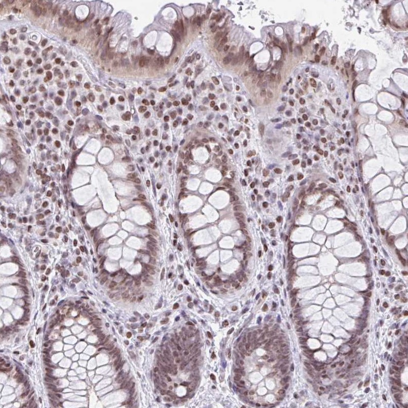Atlas Antibodies Anti-NOL6 Antibody