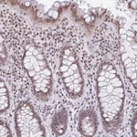 Atlas Antibodies Anti-NOL6 Antibody
