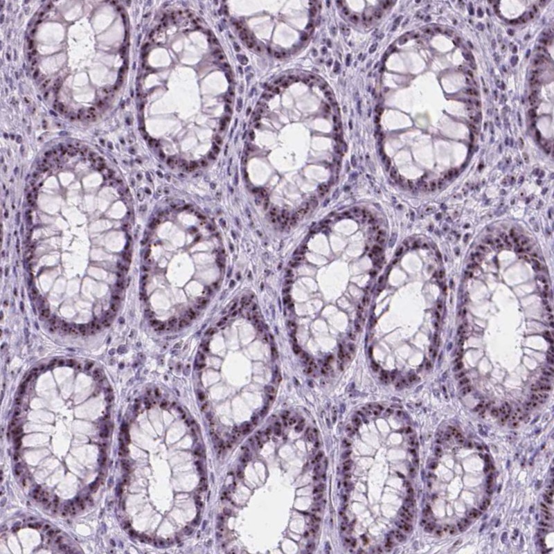 Atlas Antibodies Anti-NOL7 Antibody