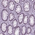 Atlas Antibodies Anti-NOL7 Antibody