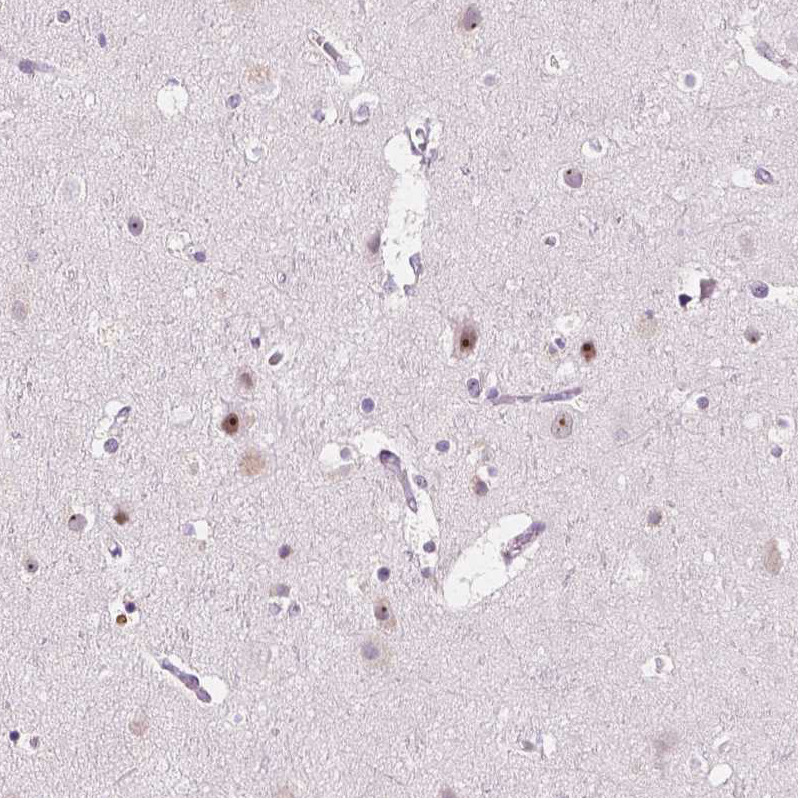 Atlas Antibodies Anti-NOLC1 Antibody
