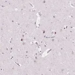 Atlas Antibodies Anti-NOLC1 Antibody