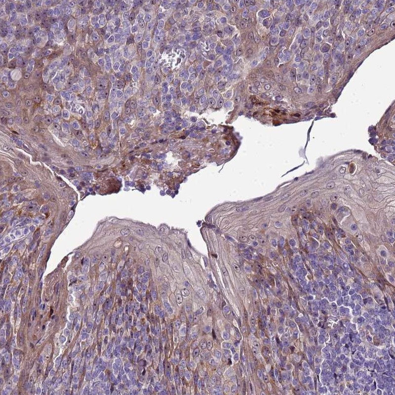 Atlas Antibodies Anti-NOL8 Antibody