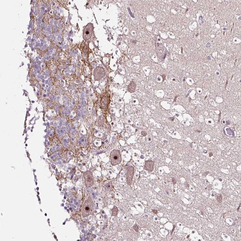 Atlas Antibodies Anti-NOM1 Antibody