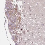 Atlas Antibodies Anti-NOM1 Antibody