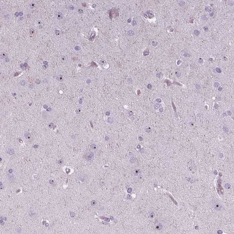 Atlas Antibodies Anti-NOLC1 Antibody