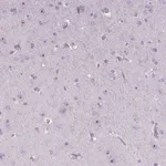 Atlas Antibodies Anti-NOLC1 Antibody