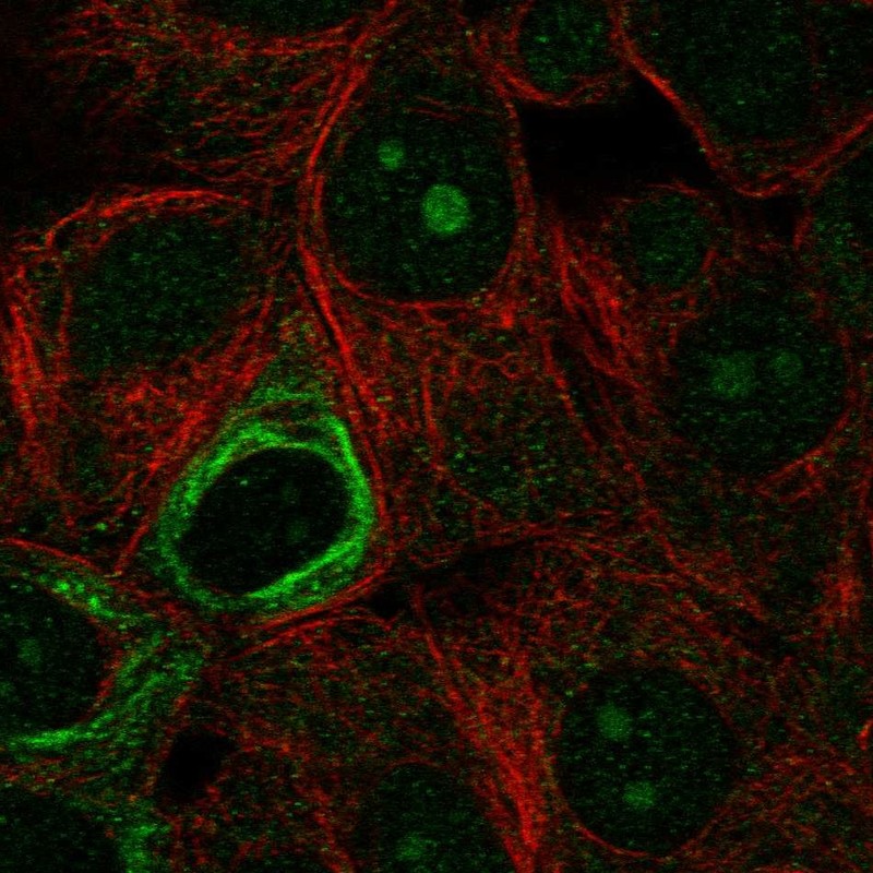 Atlas Antibodies Anti-NOL9 Antibody