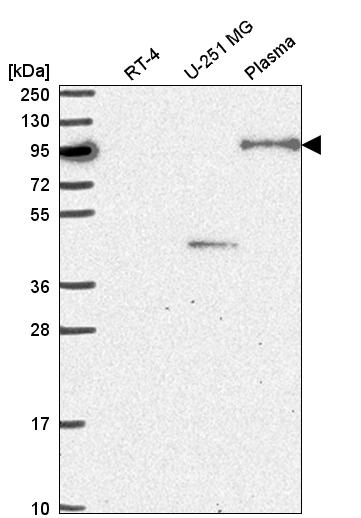 Atlas Antibodies Anti-NOM1 Antibody