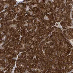 Atlas Antibodies Anti-NOMO1 Antibody